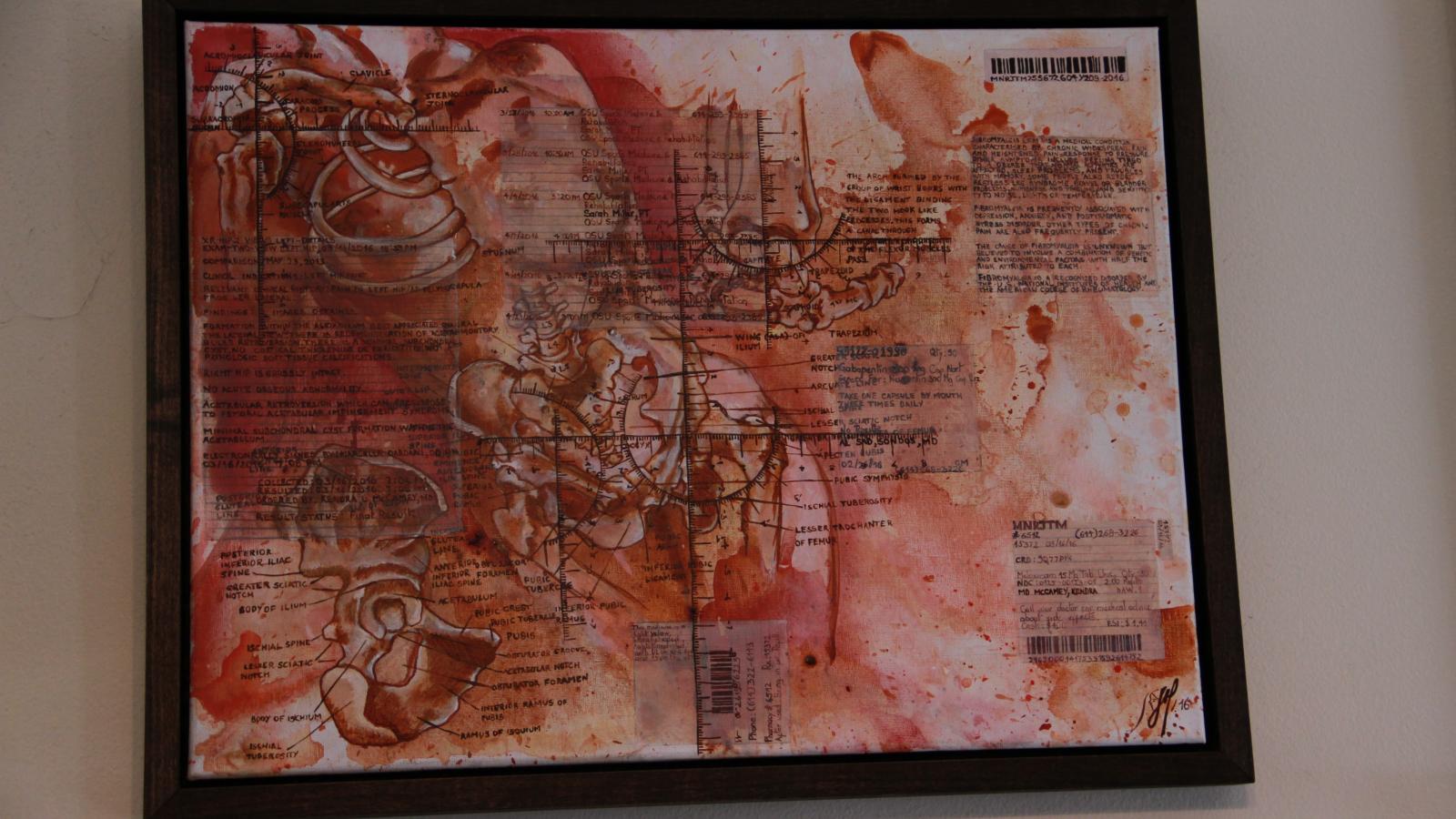Manrique's mixed media medical paintings
